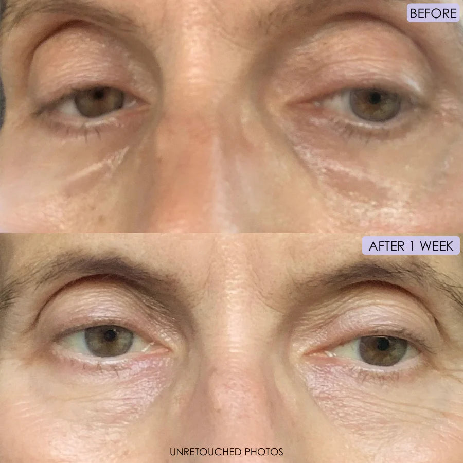 Before and after 1 week results using Caffeine Lift Eye Cream – reduced puffiness, fine lines, and brighter under-eye area