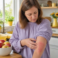 Eczema